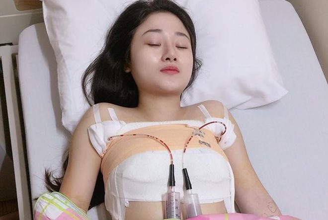 Minh Huyền quyết định nâng ngực để cải thiện vòng một chảy xệ sau sinh. Ảnh: NVCC.