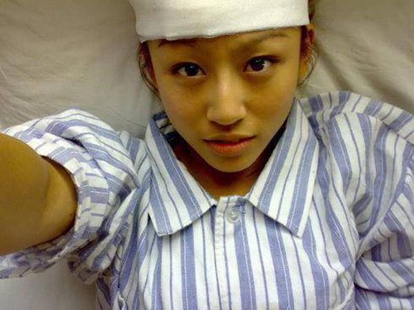 Xu Jing qua đời vì bệnh ung thư gan khi mới 22 tuổi