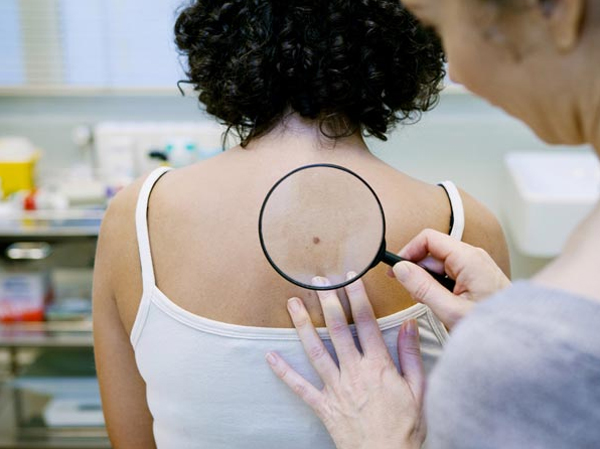 7 dấu hiệu ung thư da mà chúng ta không thể nhìn thấy bằng mắt thường