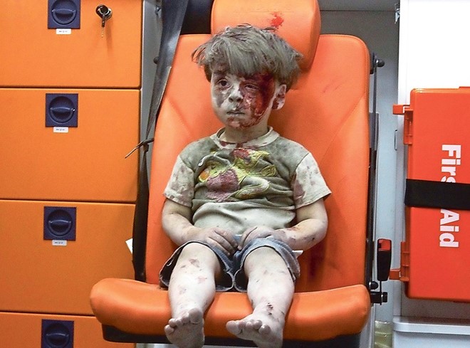 Hình ảnh bé Omran Daqneesh bị thương sau trận không kích tàn khốc ở Syria năm ngoái khiến cả thế giới xót xa