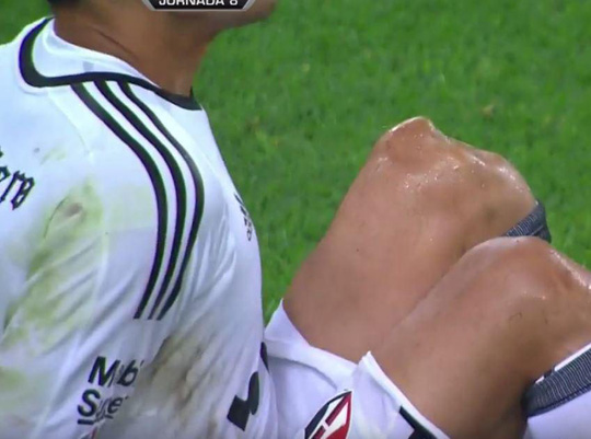 Chấn thương đầu gối của thủ môn Ustari