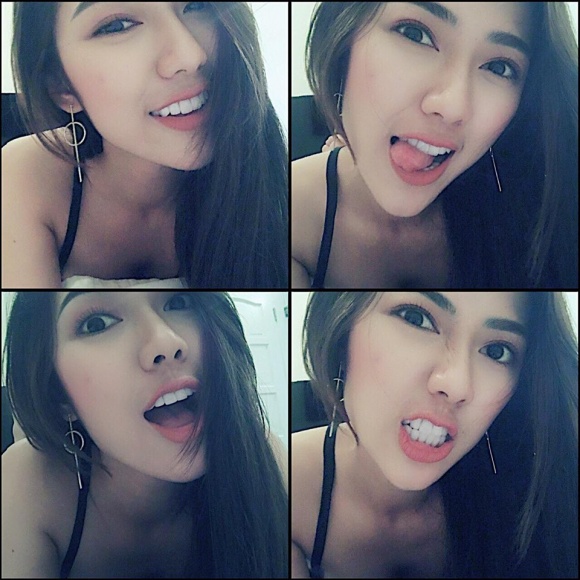 Trang Cherry với ngoại hình xinh đẹp khi làm lại răng